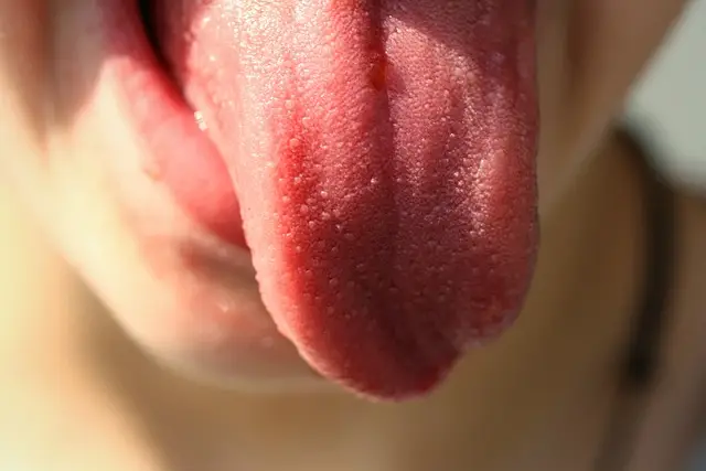 tongue color